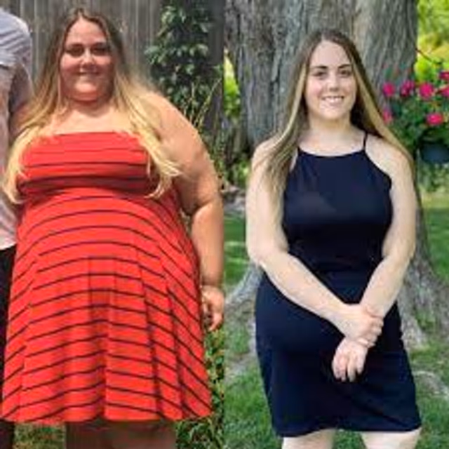 Jennifer K. before and after results - Mitolyn